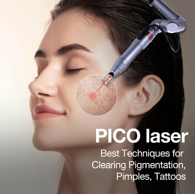 Pemulihan Laser CO2 1064nm/532nm Dapat Disesuaikan Tanpa Garansi